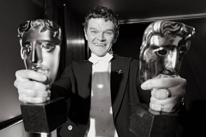 John Davidson's Tourette Syndrome Explained After Alleged Remark.webp