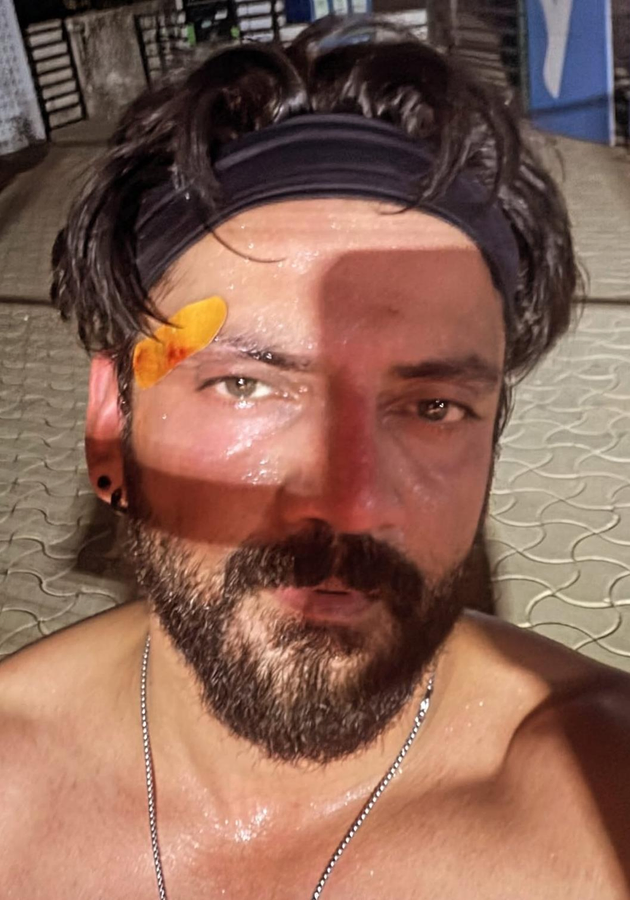 Actor Zaheer Iqbal Reports Padel Injury.webp